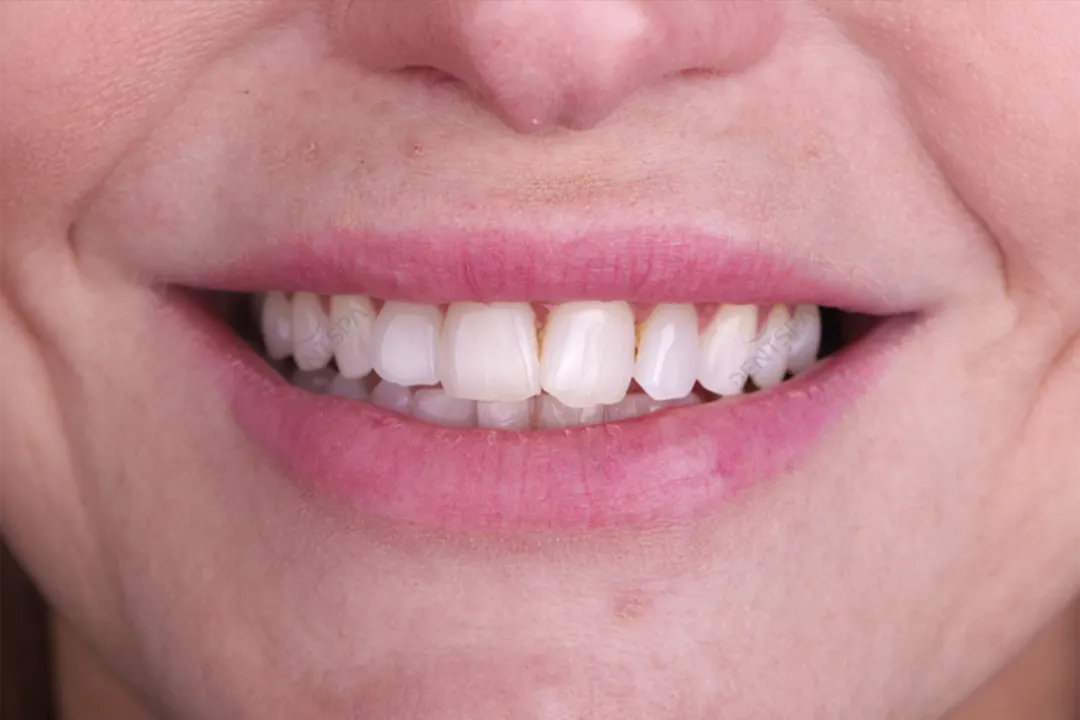 Before Image