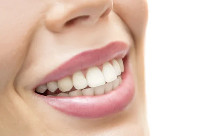 Laminate Veneers in Istanbul: Complete Guide for International Patients (2026)