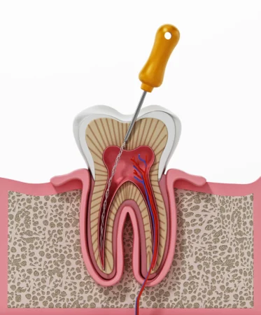 Smile Design in Istanbul: Complete Guide for International Patients (2026)